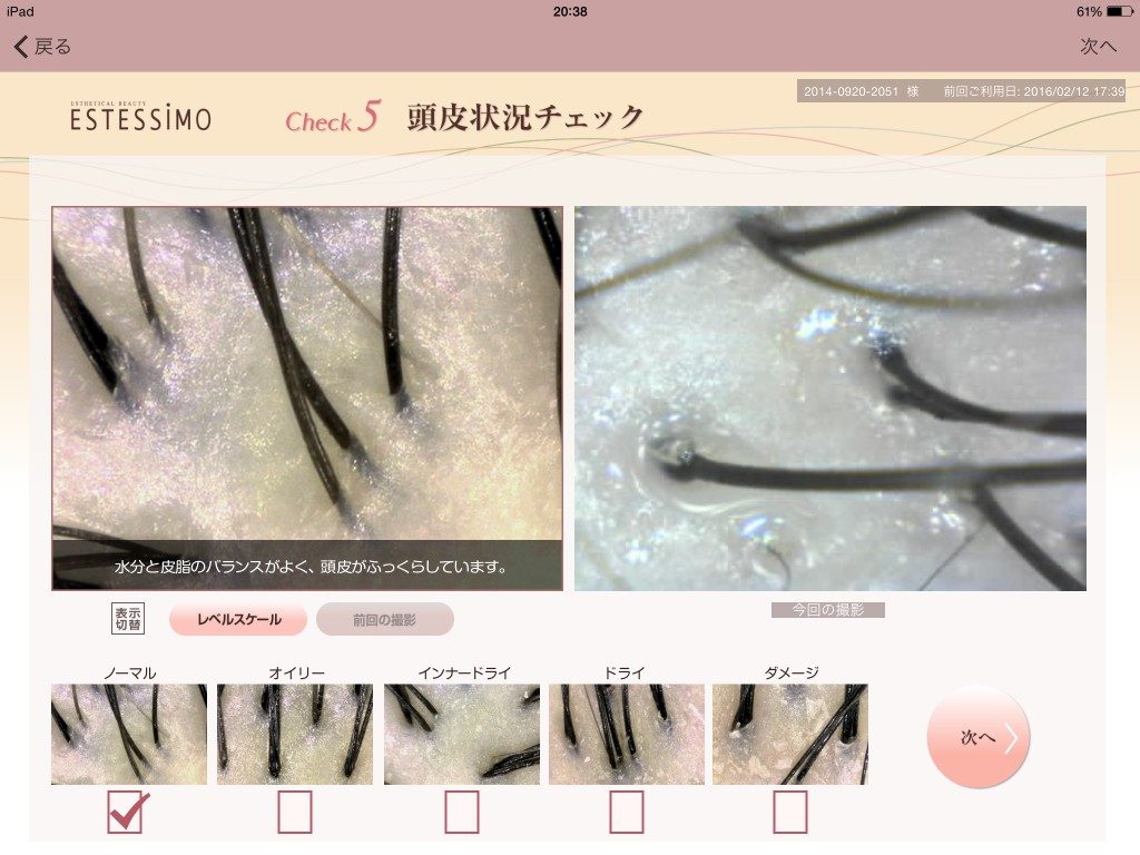 画像 頭皮状況のチェック